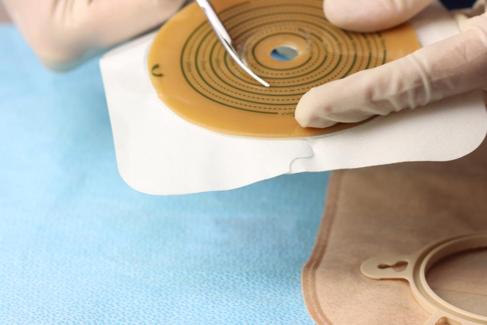 Stoma-Zuschnittschablone einreichen
